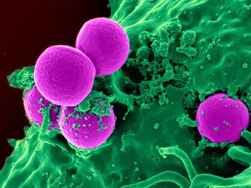 Resistente bacteriën, de stille&nbsp;pandemie